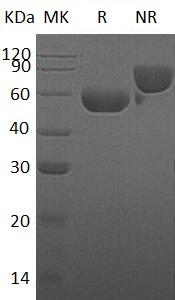 Human HYAL1/LUCA1 (His tag) recombinant protein