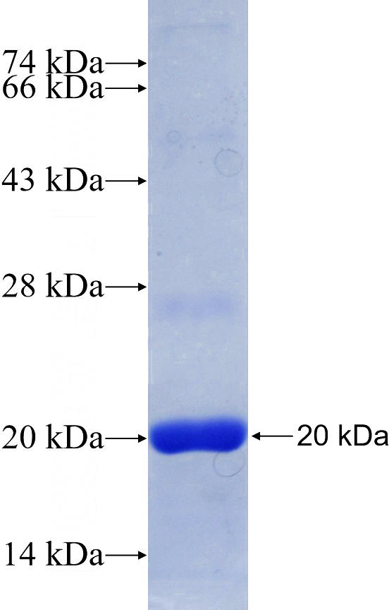 Recombinant Human MED22 SDS-PAGE