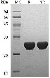 Human UBE2T/HSPC150/PIG50 (His tag) recombinant protein