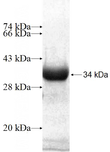 Recombinant Human RPL8 SDS-PAGE