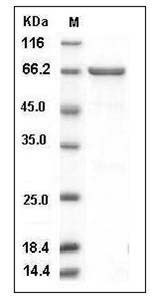 Human MEK2 / MAP2K2 / MKK2 Protein (GST Tag) SDS-PAGE