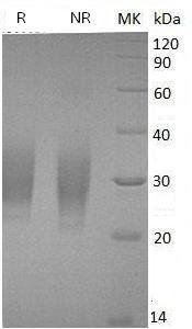 Human PTH1R/PTHR/PTHR1 (His tag) recombinant protein