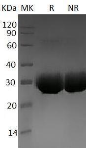 Human LAIR1/CD305 (His tag) recombinant protein