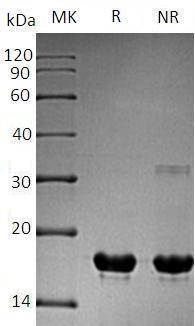 Human CUTA/ACHAP/C6orf82 (His tag) recombinant protein