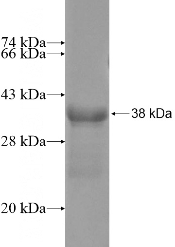 Human BTBD10 Recombinant protein (6*His tag)