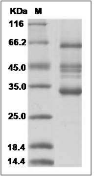 Canine IGFBP5 / IGFBP-5 Protein (Fc Tag) SDS-PAGE