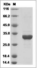 Human HSD17B14 Protein (His Tag)