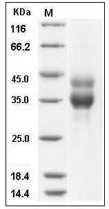 Mouse Cathepsin B / CTSB Protein (His Tag) SDS-PAGE