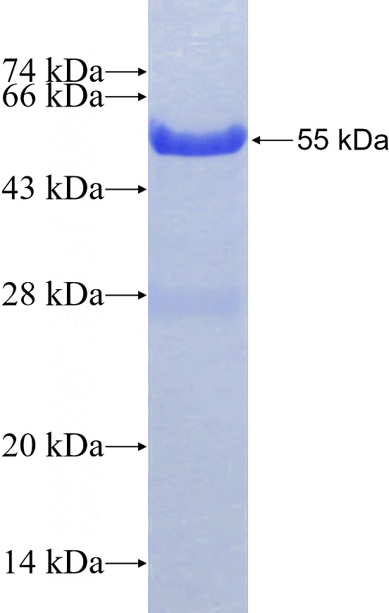 Recombinant Human IVL SDS-PAGE