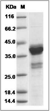 Human MKI67 Protein (GST Tag) SDS-PAGE