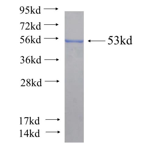 Recombinant human HYAL4 SDS-PAGE