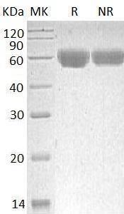 Human TNFRSF11B/OCIF/OPG (His tag) recombinant protein