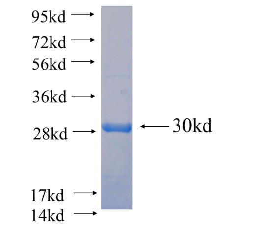 Recombinant human RAB11A SDS-PAGE