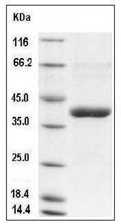 Human CANT1 Protein (His Tag) SDS-PAGE