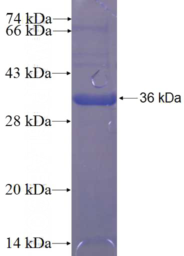 Recombinant Human TM9SF2 SDS-PAGE