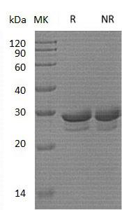 Human CSN2/CASB (His tag) recombinant protein