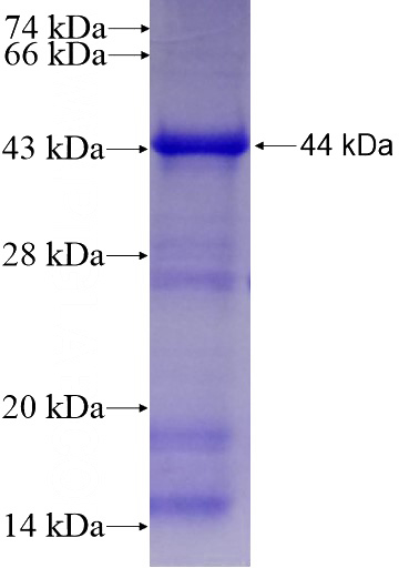 Recombinant Human ICA1L SDS-PAGE