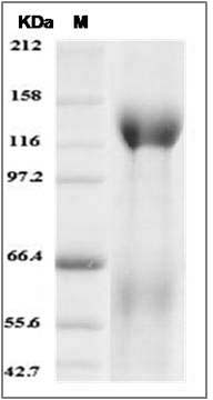 Mouse Contactin 5 / CNTN5 Protein (His Tag) SDS-PAGE