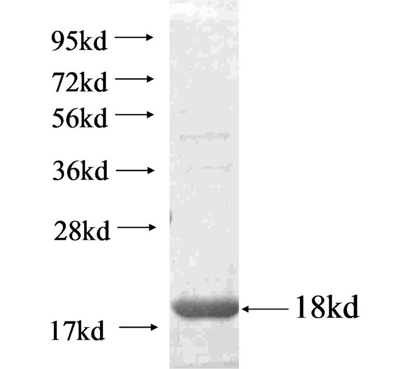 Recombinant Arabidopsis thaliana DYW1 SDS-PAGE