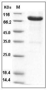 Mouse IL13RA2 / CD213A2 Protein (His & Fc Tag) SDS-PAGE