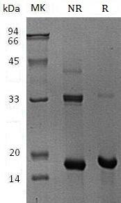 Human ZNF100 (His tag) recombinant protein