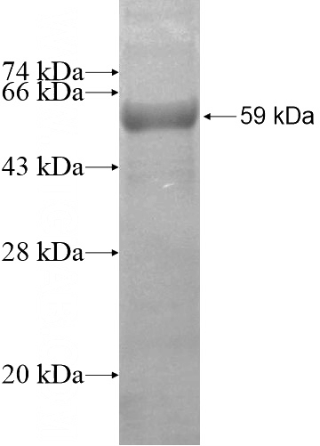Recombinant Human GAL3ST1 SDS-PAGE