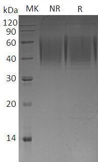 Mouse Tnfrsf8 (His tag) recombinant protein