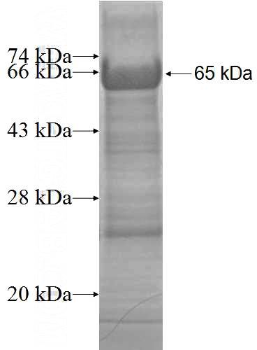 Recombinant Human PCDH8 SDS-PAGE