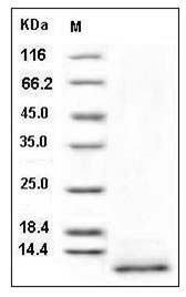 Human CD9 / Tspan-29 Protein (His Tag) SDS-PAGE