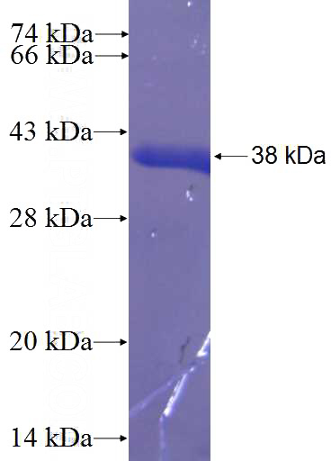 Recombinant Human GHDC SDS-PAGE