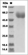 Human IL1RL2 / IL-1Rrp2 Protein (His Tag)