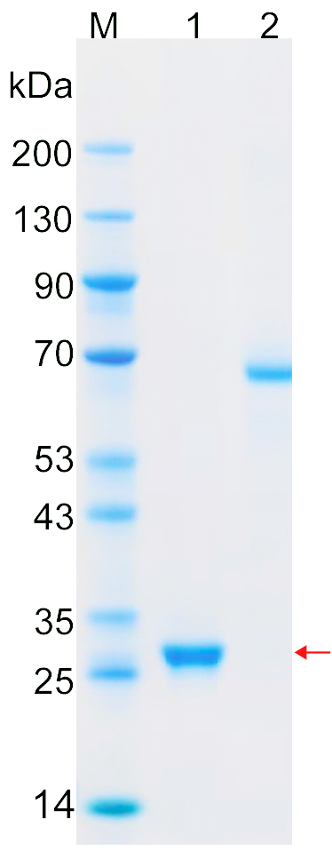 Recombinant NQO2 protein (His tag) SDS-PAGE