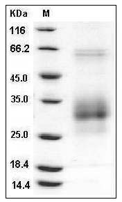 Rat FAS / CD95 / APO-1 / TNFRSF6 Protein (His Tag) SDS-PAGE
