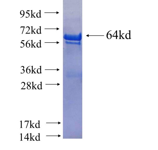 Recombinant human TBRG4 SDS-PAGE