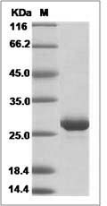 Ebola virus EBOV (subtype Zaire, strain H.sapiens-wt/GIN/2014/Kissidougou-C15) VP24 Protein (His Tag)