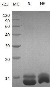 Human CXCL1/GRO/GRO1/GROA/MGSA/SCYB1 (His tag) recombinant protein