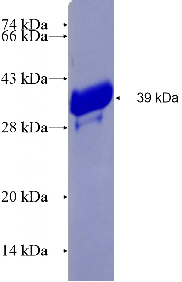 Recombinant Human FAM83F SDS-PAGE
