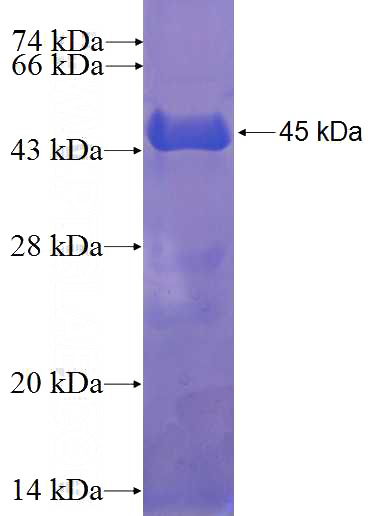 Recombinant Human NUDT15 SDS-PAGE