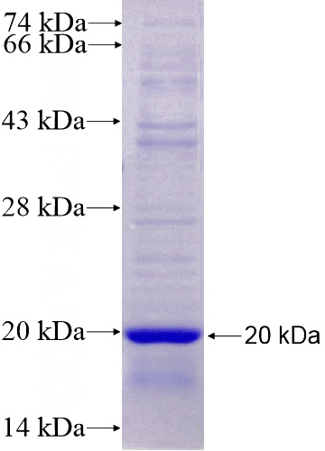 Recombinant Human NHE8 SDS-PAGE