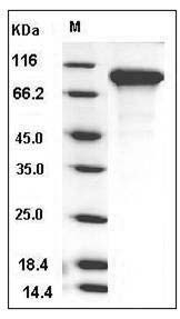 Mouse DDR2 Kinase / CD167b Protein (His Tag) SDS-PAGE