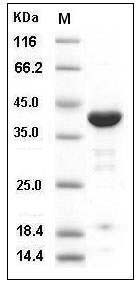Human ACP1 / LMW-PTP Protein (GST Tag) SDS-PAGE
