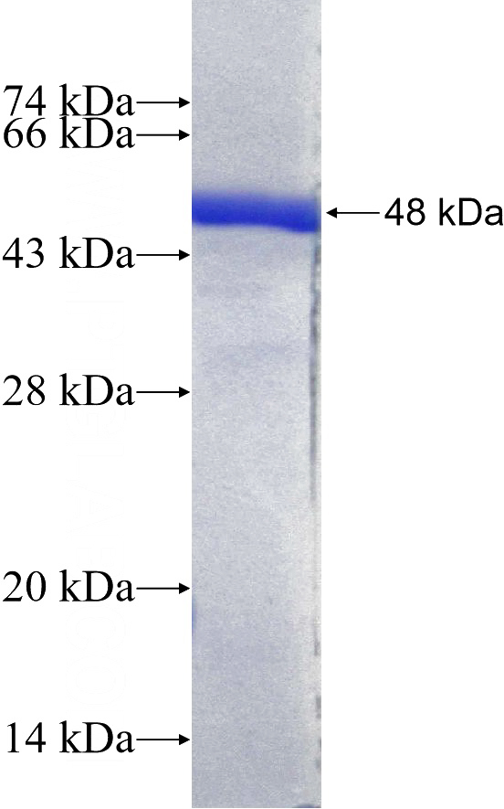 Recombinant Human EFCAB2 SDS-PAGE