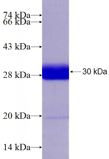 Recombinant Human CXXC5 SDS-PAGE