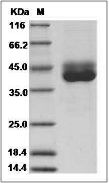 Canine IL13RA2 / IL13R Protein (His Tag) SDS-PAGE
