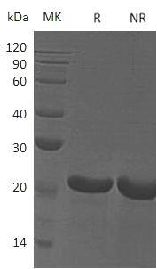 Human FTH1/FTH/FTHL6/OK/SW-cl.84/PIG15 recombinant protein
