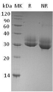 Human CTRL/CTRL1 (His tag) recombinant protein