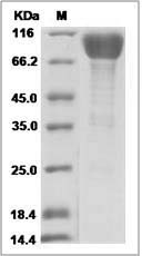 Ebola virus EBOV (subtype Sudan, strain Gulu) GP-RBD / Glycoprotein Protein (Fc Tag)