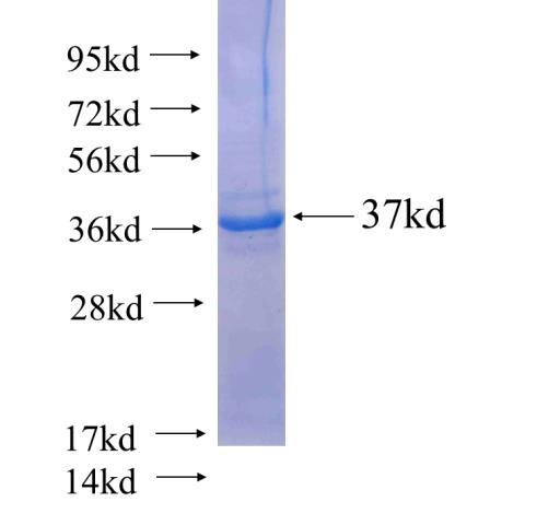 Recombinant human SLC25A10(Full length) SDS-PAGE