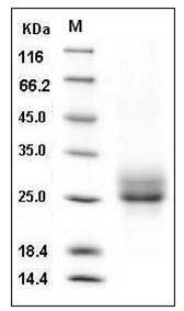 Human RELT / TNFRSF19L Protein (His Tag) SDS-PAGE