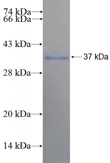 Human JMJD3 Recombinant protein (GST tag)
